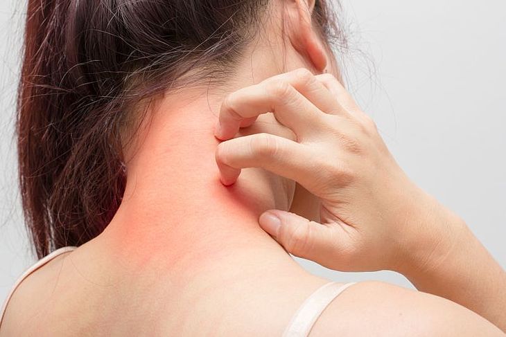 How to take care of atopic skin? Methods to deal with dry and itchy skin